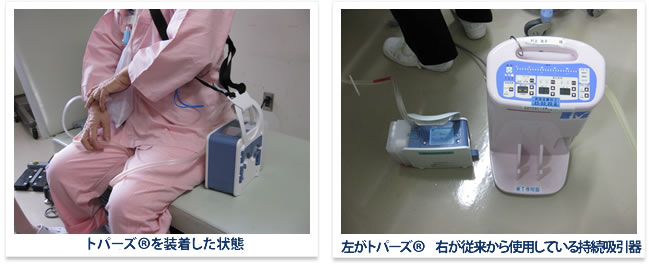 トパーズ®を装着した状態・左がトパーズ® 右が従来から使用している持続吸引器