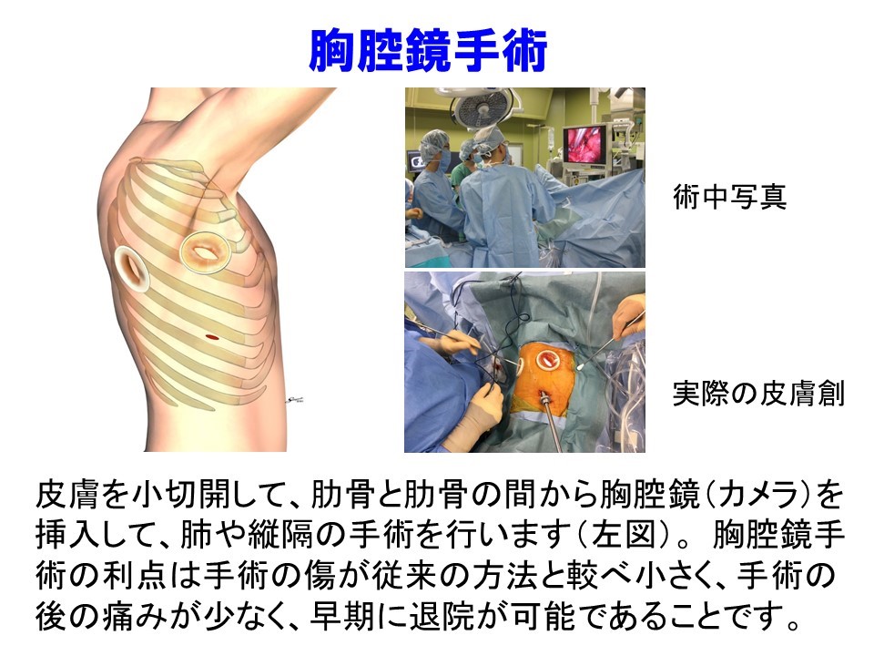 最新のデザイン 呼吸器外科手術縦隔・胸膜・胸壁 イラストと動画で学ぶ